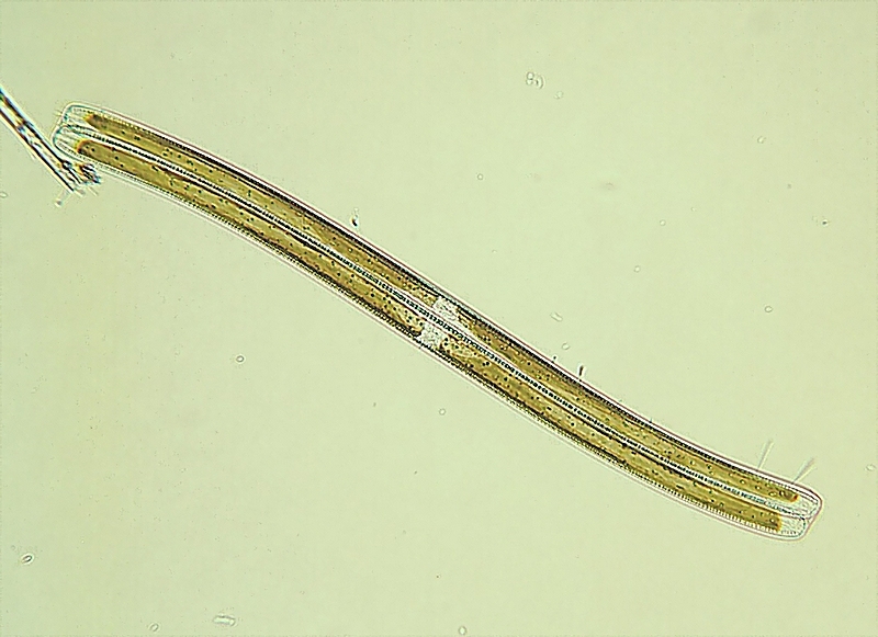 Nitzschia sigmoidea